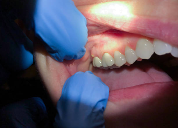 Best Pediatric Emergency Dentist in Seeley, CA